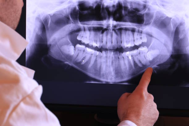 Best Broken or Cracked Tooth Emergency Dentist in Fairfield, IA