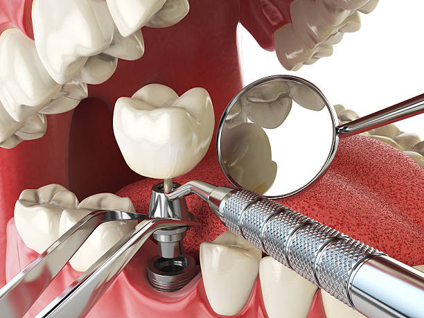 Best Mobile Emergency Dentist in Fairfield, IA