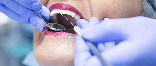 Best Emergency Dental Extractions in Fairfield, IA